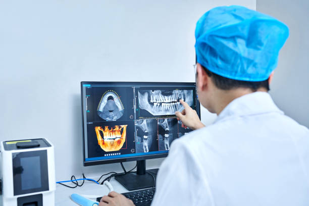 Best Emergency Wisdom Tooth Extraction in Woodcreek, TX